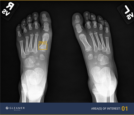 2025-First in Region to Use AI for X-Rays at All Emergency Rooms