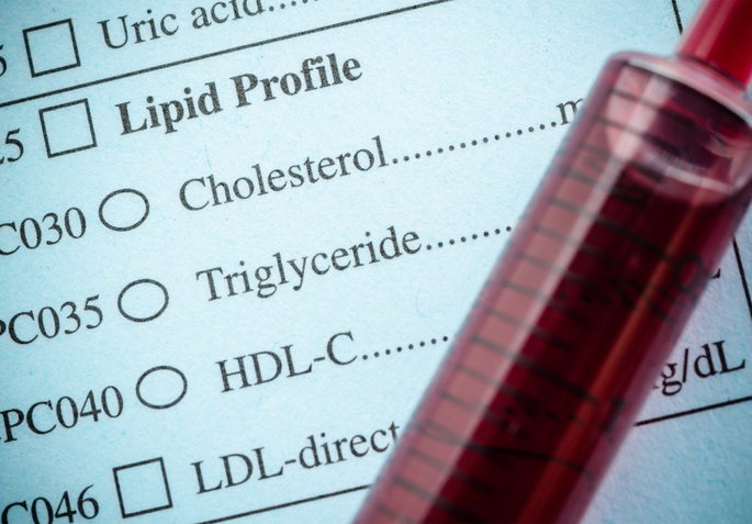 cholesterol testing