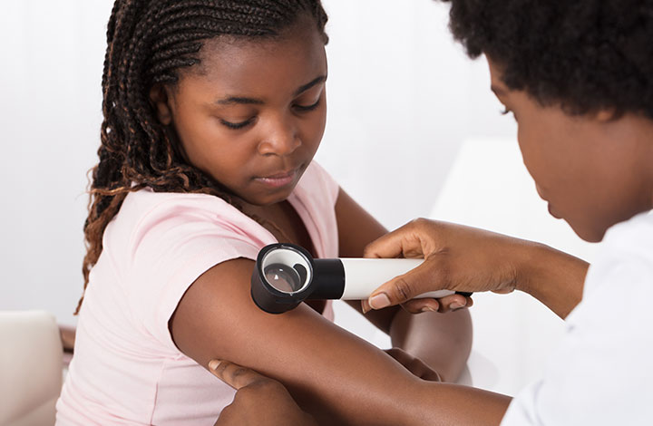 Nationally Renowned St. Luke's Pediatric Dermatologist