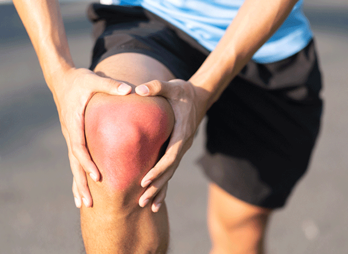ACL Repair for Knee Injuries