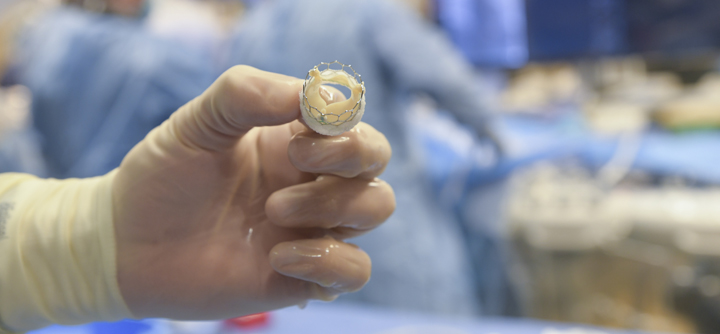 Sapien Heart Valve