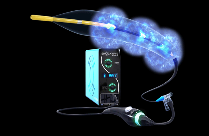 Shockwave Coronary Balloon Lithotripsy