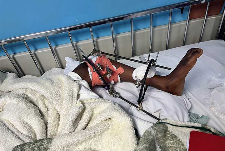 Knee, post operation