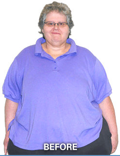 Michelle Stoneback Before