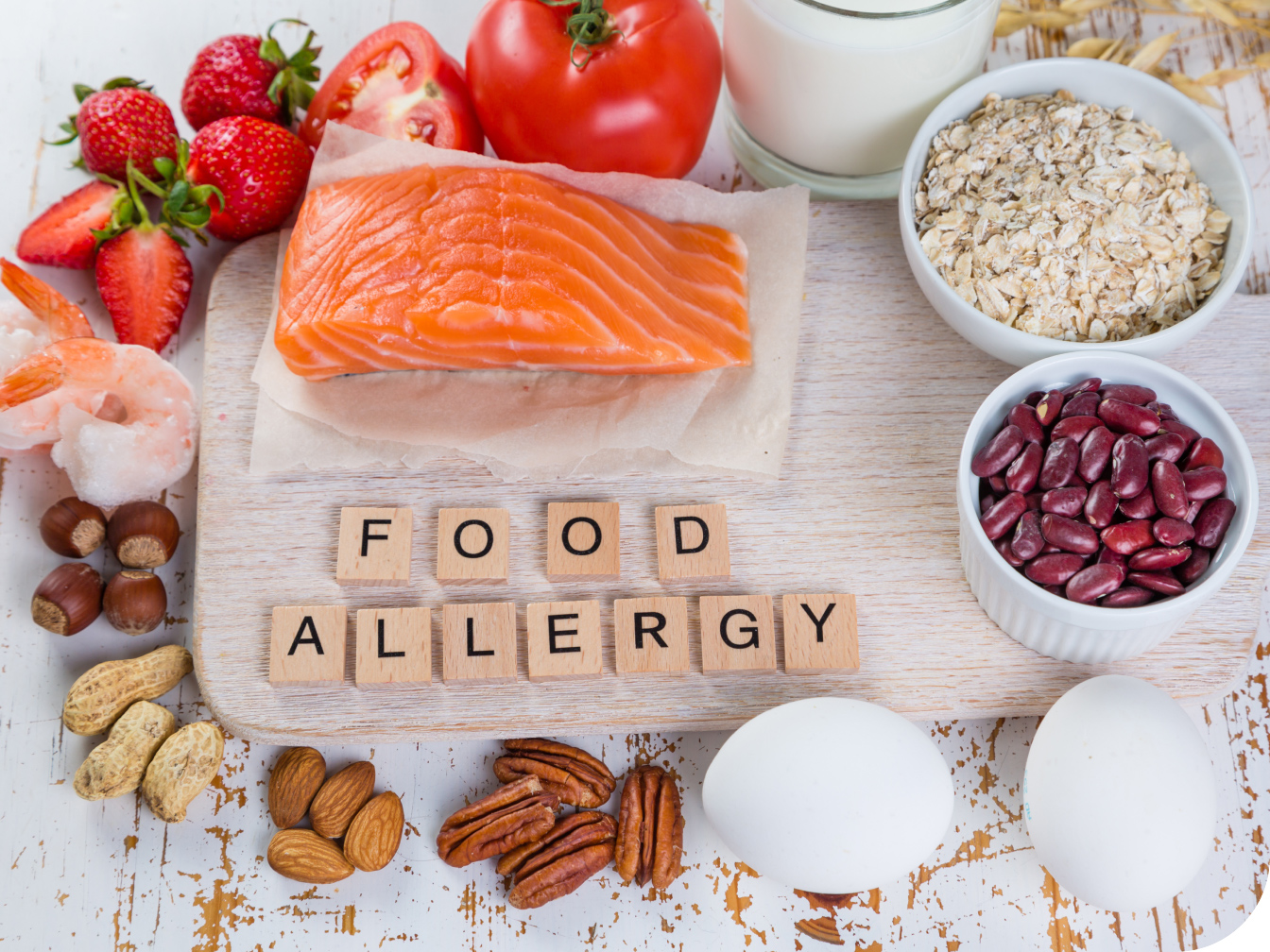 Food allergy