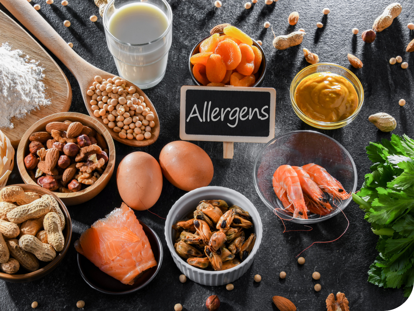 Foods surrounding an allergen sign