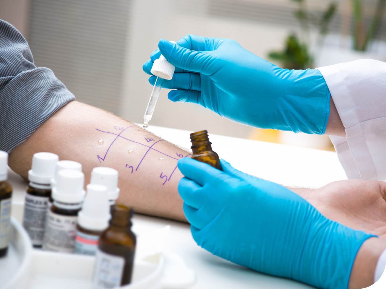 Individual having allergy testing