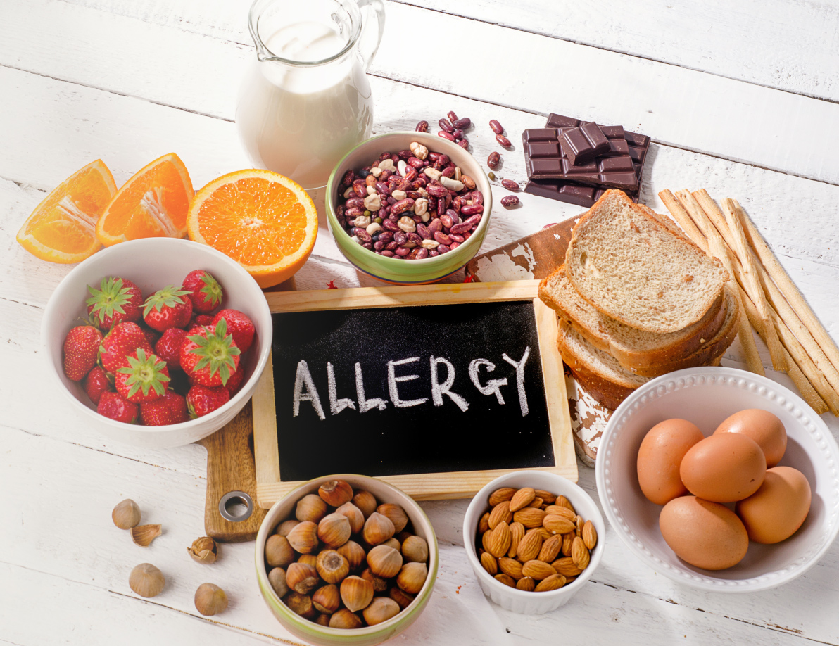 Healthy foods surrounding an allergy sign