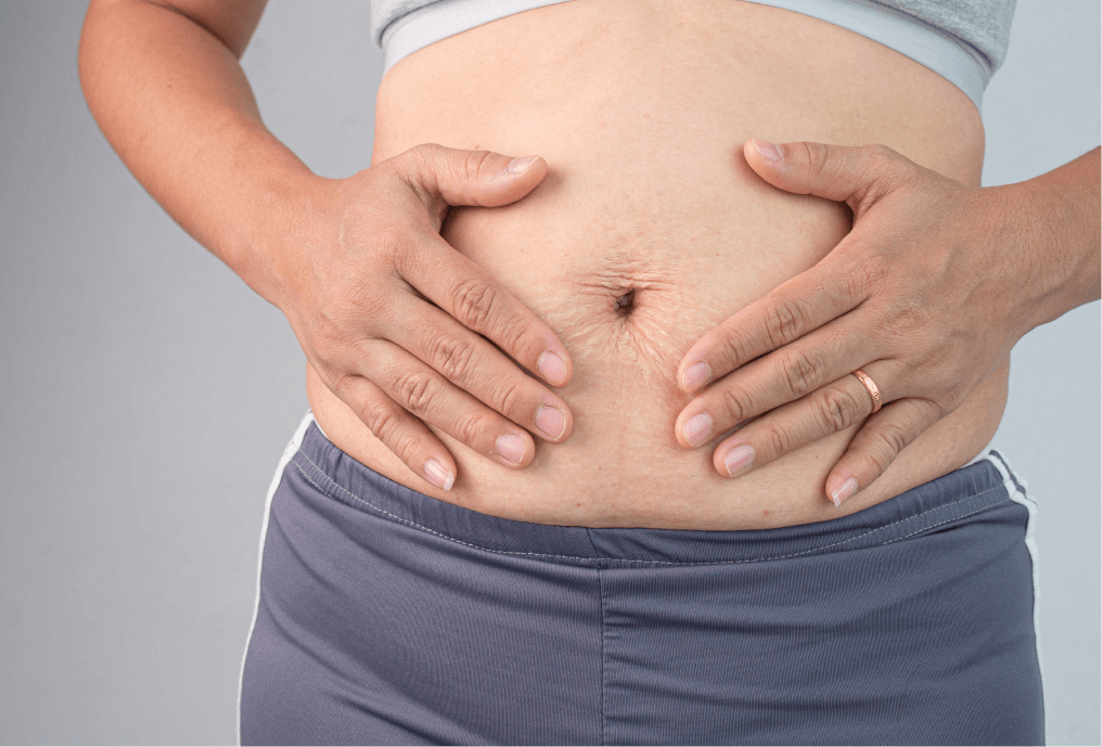 Postpartum woman touching her stomach