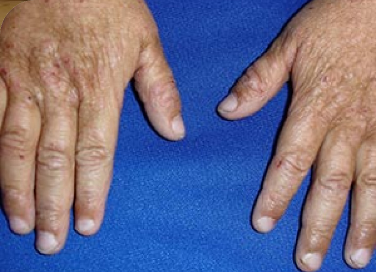 Hands on blue fabric