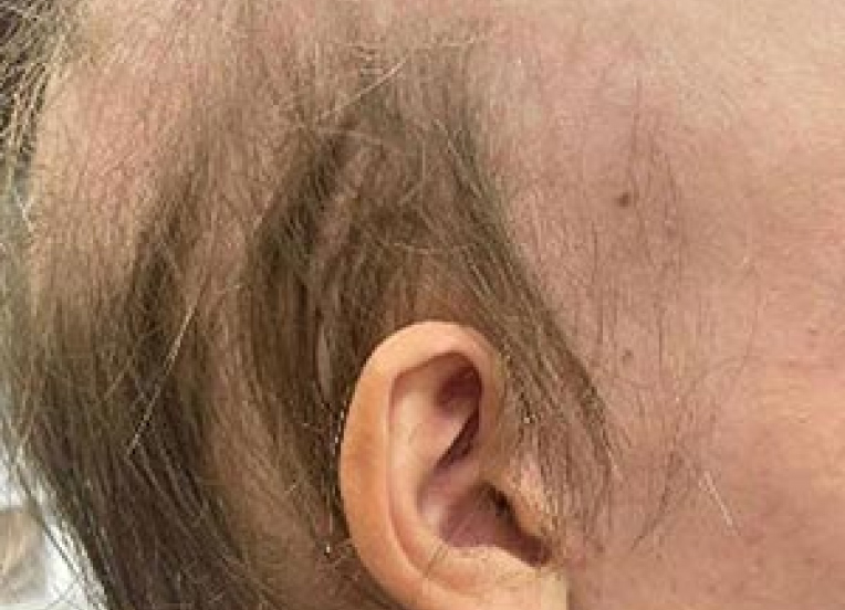 Side of individuals head