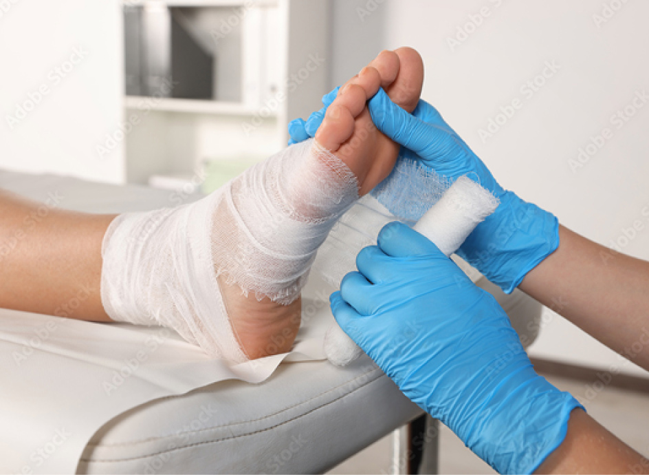 Medical Professional wrapping a patient's hurt foot