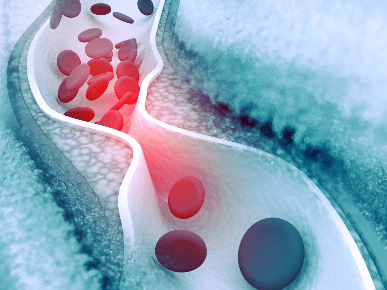 Lipid management graphic