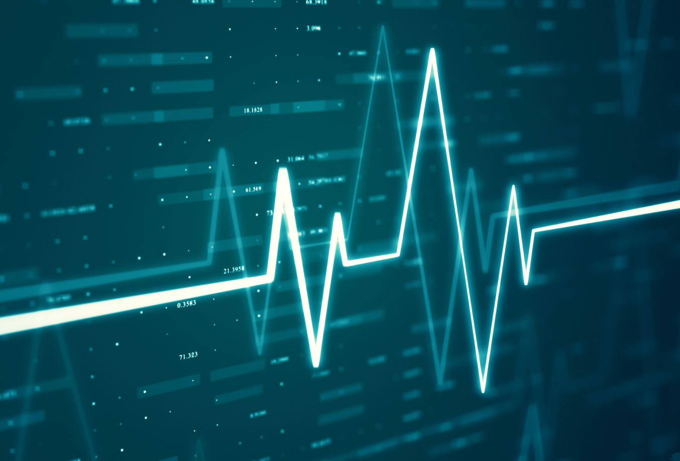 Graphic of pulse chart