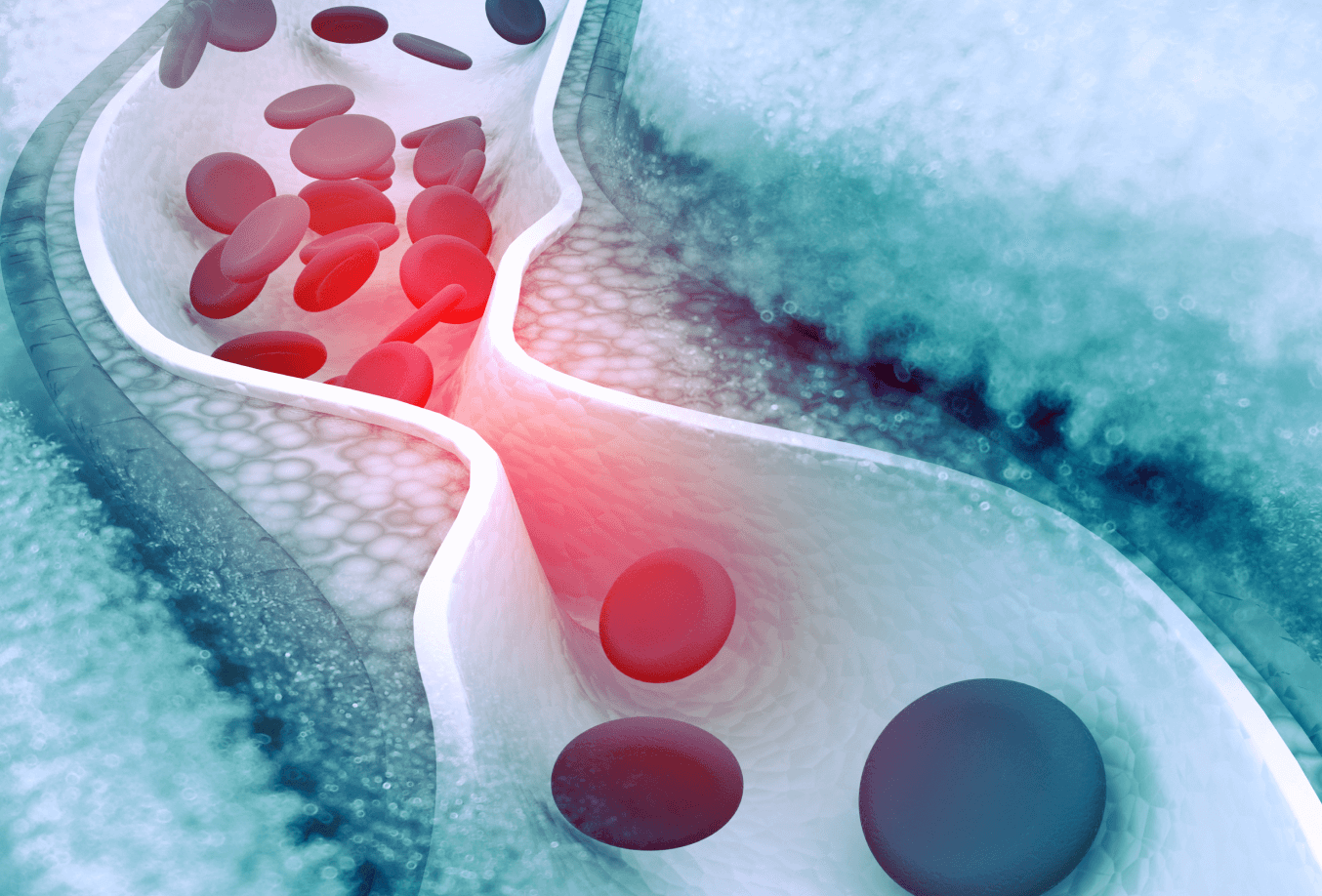 Lipid management graphic