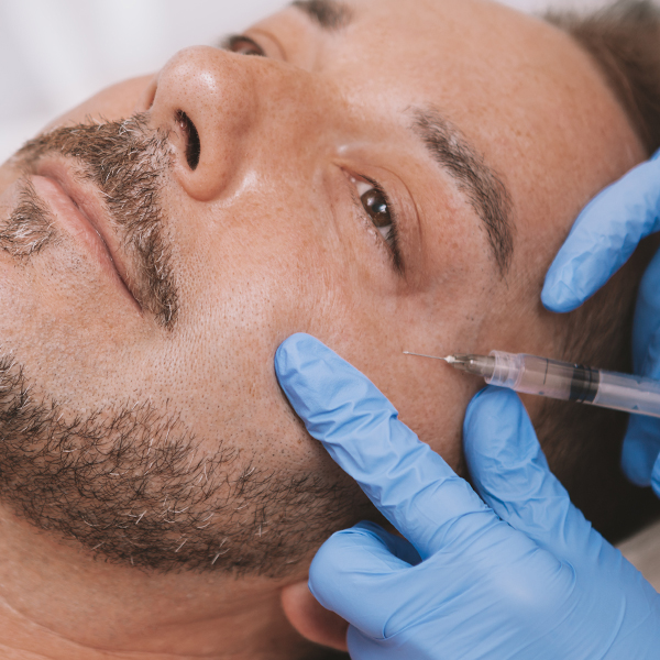 Man receiving a Botox injection in his Crow's Feet area near his eye