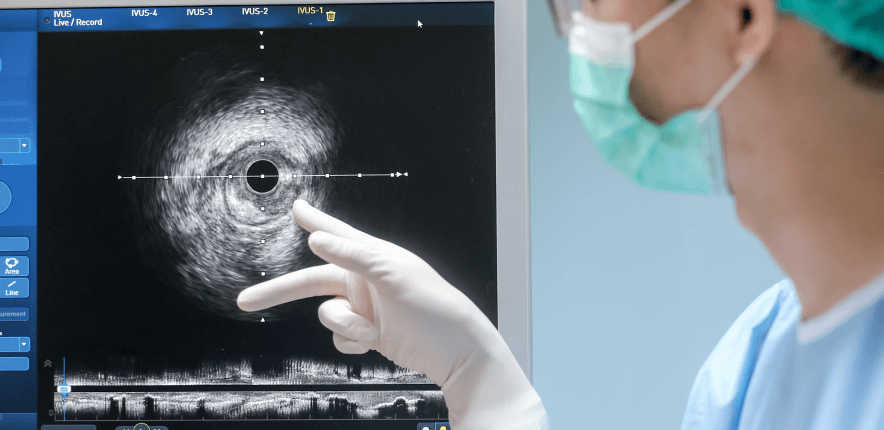 A doctor examining xray