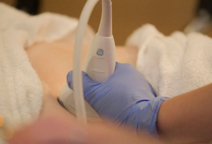 Medical Professional giving a patient an ultrasound