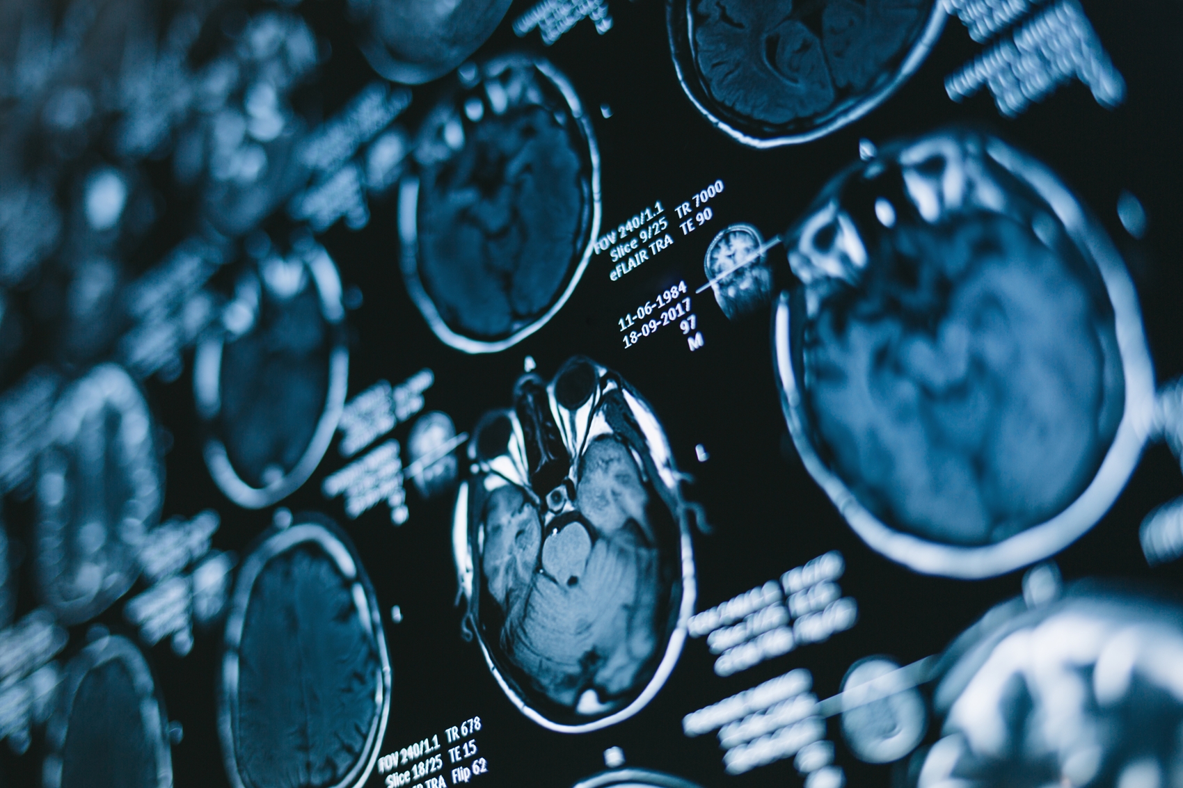 Medical scan results