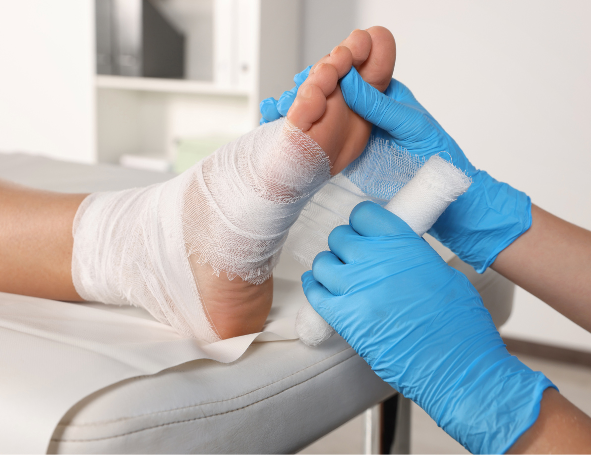 Medical professional wrapping a patient's foot with gauze